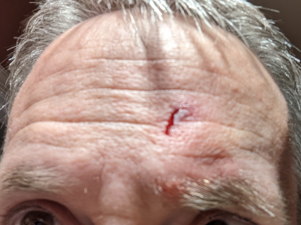 20220602_tireIronForehead.jpg